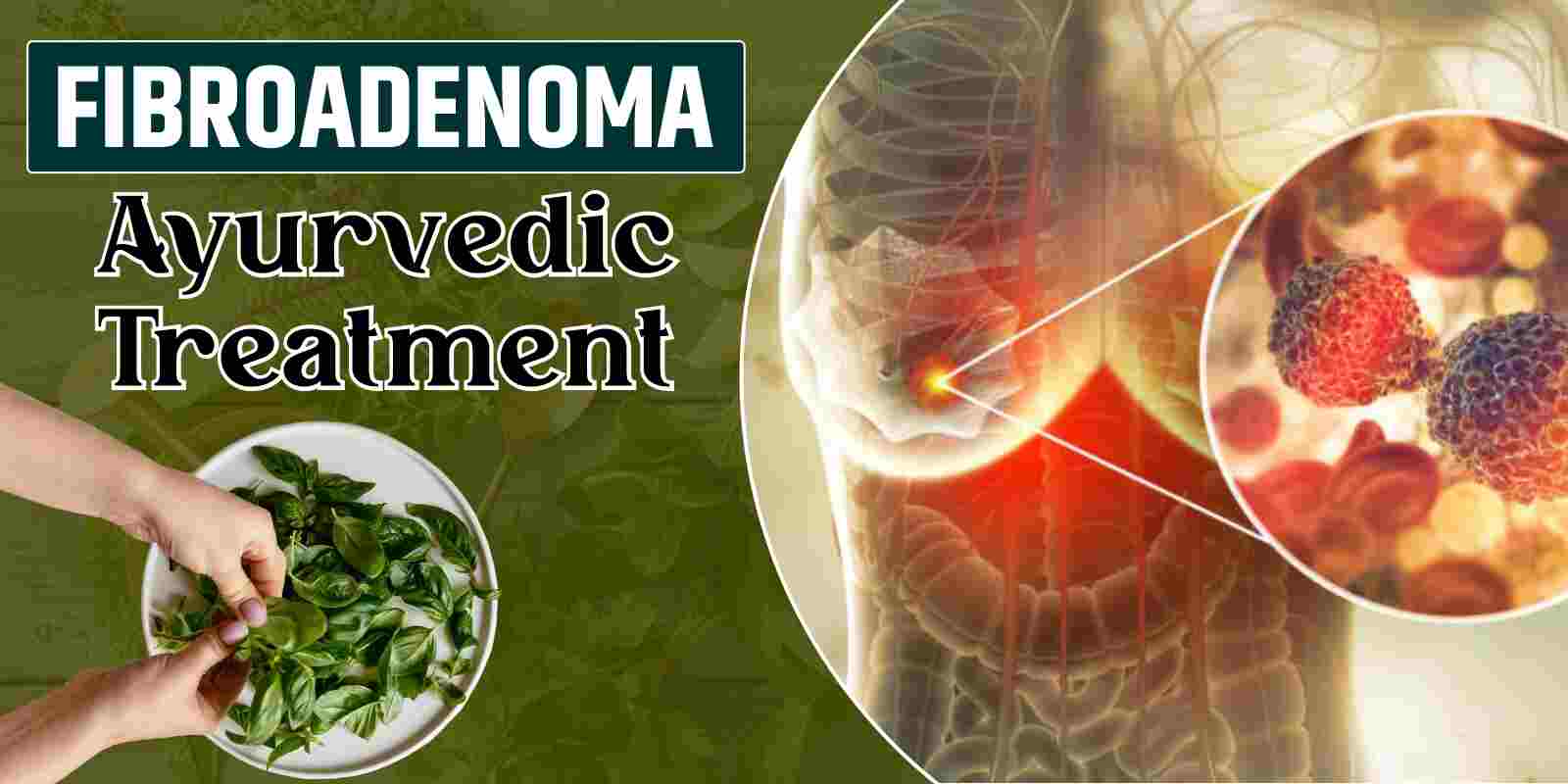 Fibroadenoma Ayurvedic Treatment